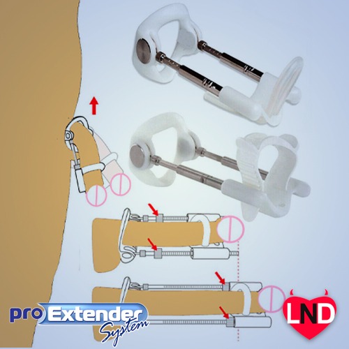 ProExtender - Penis Enlargement System 5G PED-004 - Image 3